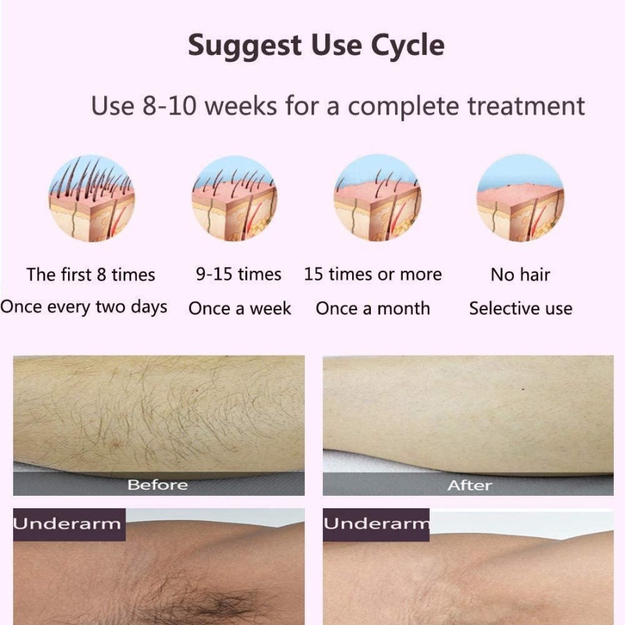 Umate Permanent Hair Removal Device Umate Permanent Hair Removal Device