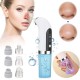 Blackhead Remover Vacuum Pore Cleaner