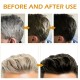 Soap Cover Black Soap for Gray Hair, Gray Hair Reverse Bar Shampoo 50g Soap Cover Black Soap for Gray Hair, Gray Hair Reverse Bar Shampoo 50g
