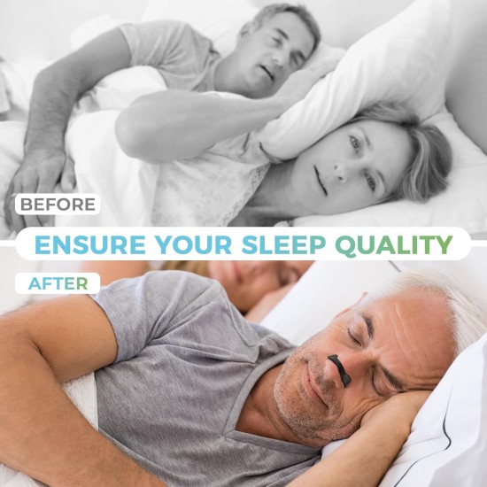  Anti-Snoring Magnetic Nose Nasal Strips - 30Pcs