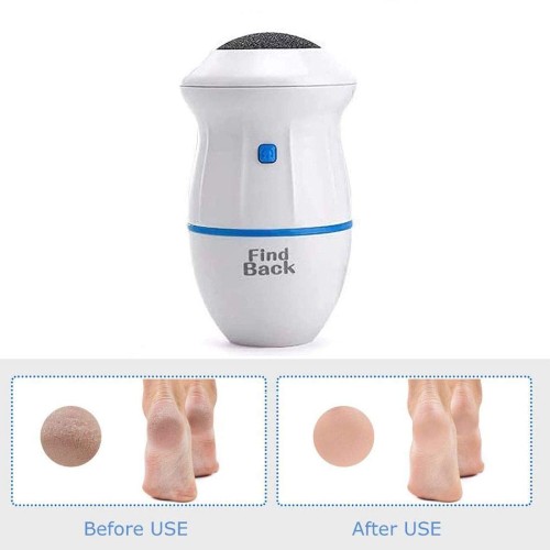 Callus Remover Pedicure Foot Care Tools