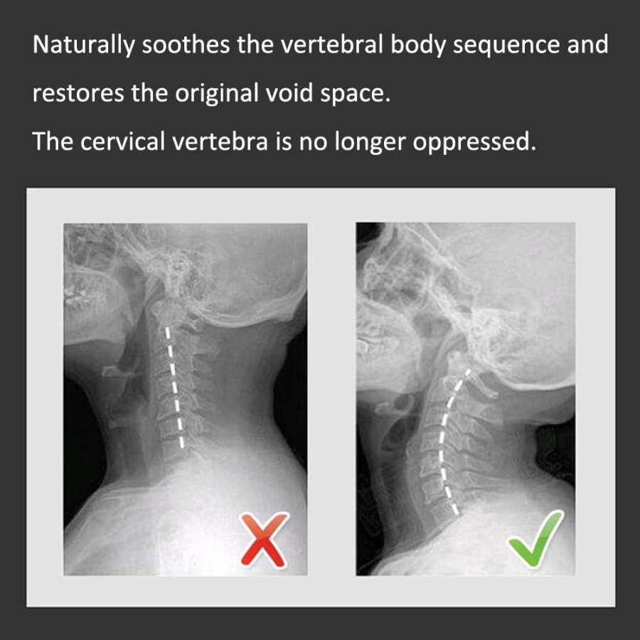 Cervical Traction physiotherapy Device