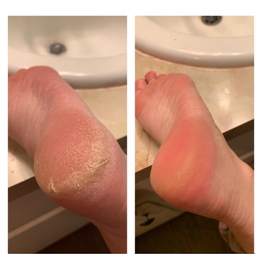 Pedegg Amazing Foot Cream