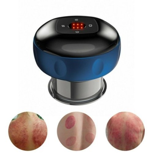 Intellegent Smart Cupping Therapy Massager (Hijama)