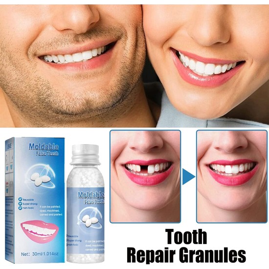 Moldable Fasle Teeth Repair Kit